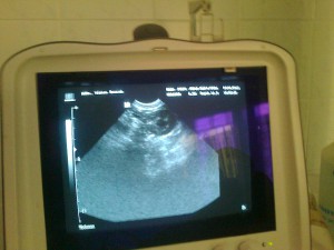 elba-ultrazvuk.jpg